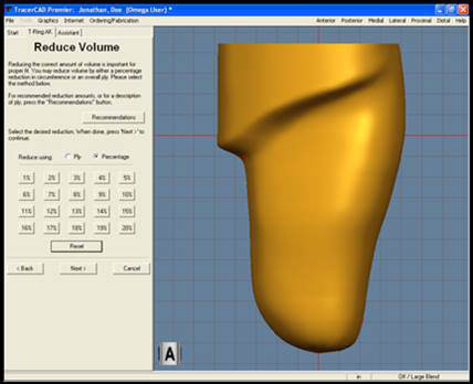 Upper Extremity Prosthetics & Prosthesis