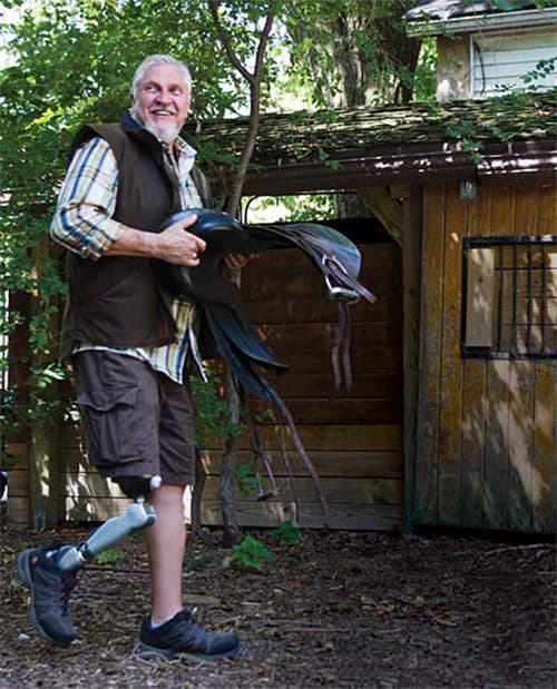 Prosthetics in St. Louis | Symbionic Leg